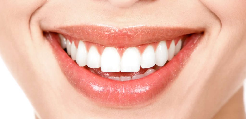 Diseño de sonrisa Diseño de sonrisa