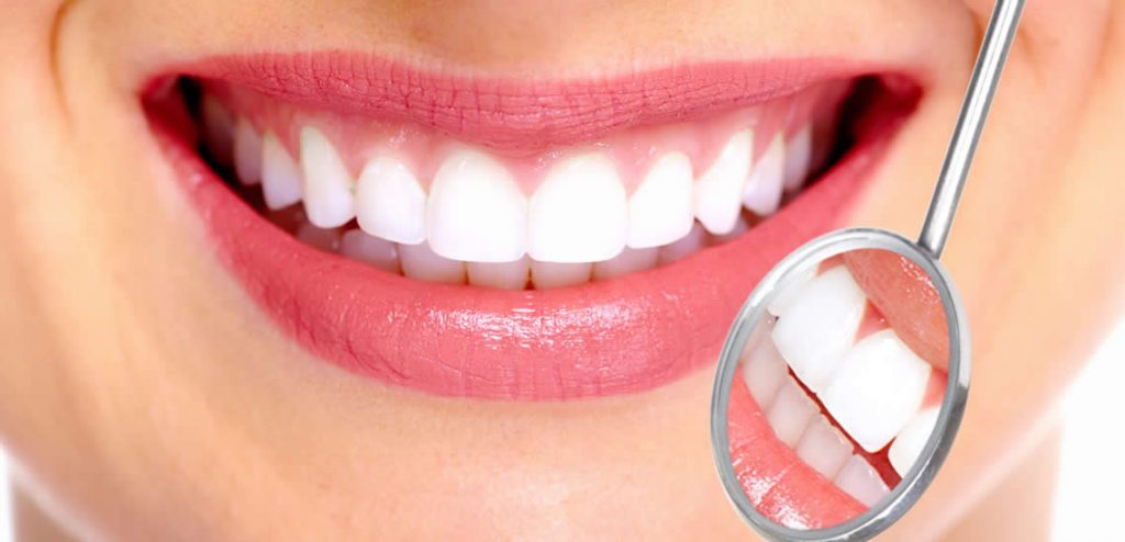 Preguntas frecuentes sobre el blanqueamiento dental Preguntas frecuentes sobre el blanqueamiento dental